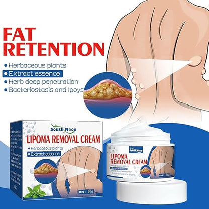 Lipoma Removal Cream | Special Price Offer
